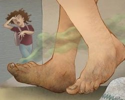 Как избавиться от потливости ног. Кроме неприятного запаха потливость ног приносит и другие неприятные моменты
